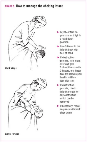 Infant Choking Chart